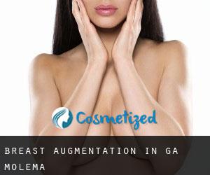 Breast Augmentation in Ga-Molema