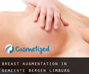 Breast Augmentation in Gemeente Bergen (Limburg)