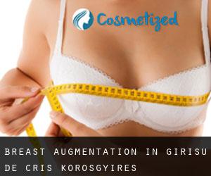 Breast Augmentation in Girişu de Criş / Kőrösgyíres
