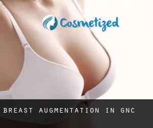Breast Augmentation in Gǝncǝ Breast Augmentation in Gǝncǝ
