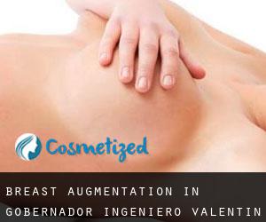 Breast Augmentation in Gobernador Ingeniero Valentín Virasoro