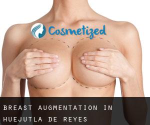 Breast Augmentation in Huejutla de Reyes
