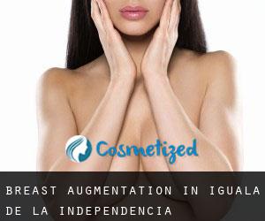 Breast Augmentation in Iguala de la Independencia