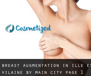Breast Augmentation in Ille-et-Vilaine by main city - page 1
