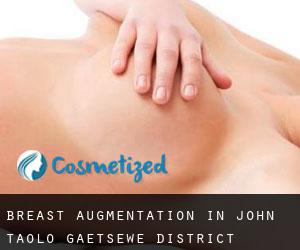 Breast Augmentation in John Taolo Gaetsewe District Municipality