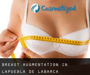 Breast Augmentation in Lapuebla de Labarca