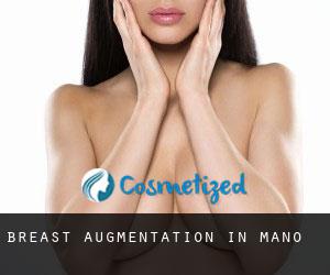 Breast Augmentation in Maño