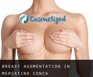 Breast Augmentation in Mercatino Conca