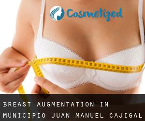Breast Augmentation in Municipio Juan Manuel Cajigal