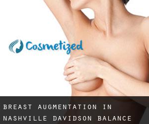 Breast Augmentation in Nashville-Davidson (balance)