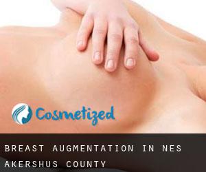 Breast Augmentation in Nes (Akershus county)
