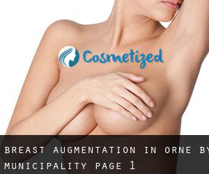 Breast Augmentation in Orne by municipality - page 1