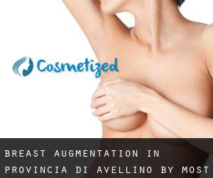 Breast Augmentation in Provincia di Avellino by most populated area - page 1