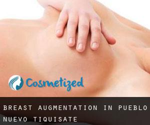 Breast Augmentation in Pueblo Nuevo Tiquisate