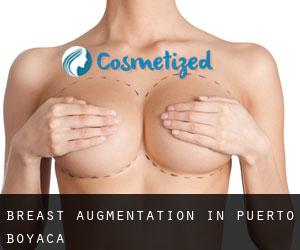 Breast Augmentation in Puerto Boyacá