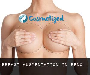Breast Augmentation in Reno