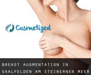 Breast Augmentation in Saalfelden am Steinernen Meer