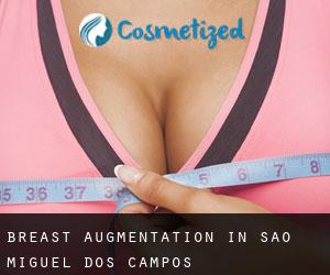 Breast Augmentation in São Miguel dos Campos