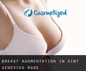 Breast Augmentation in Sint-Genesius-Rode