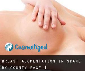 Breast Augmentation in Skåne by County - page 1