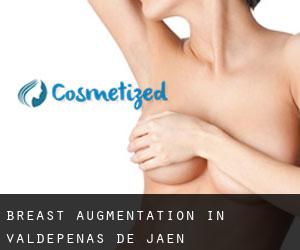 Breast Augmentation in Valdepeñas de Jaén