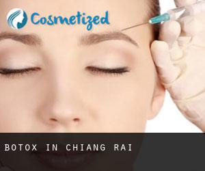 Botox in Chiang Rai Botox in Chiang Rai
