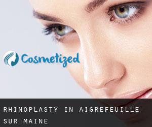 Rhinoplasty in Aigrefeuille-sur-Maine