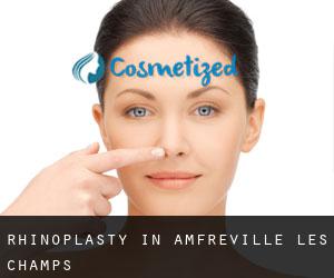 Rhinoplasty in Amfreville-les-Champs