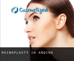 Rhinoplasty in Anqing