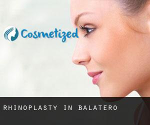 Rhinoplasty in Balatero