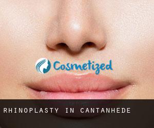 Rhinoplasty in Cantanhede