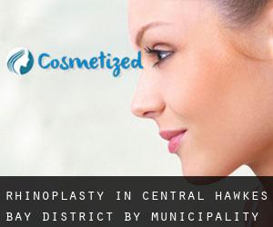 Rhinoplasty in Central Hawke's Bay District by municipality - page 1
