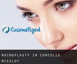 Rhinoplasty in Corcelle-Mieslot