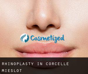 Rhinoplasty in Corcelle-Mieslot