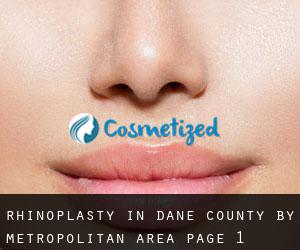 Rhinoplasty in Dane County by metropolitan area - page 1