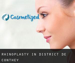 Rhinoplasty in District de Conthey