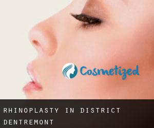 Rhinoplasty in District d'Entremont