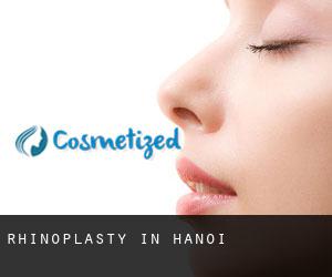 Rhinoplasty in Hanoi Rhinoplasty in Hanoi
