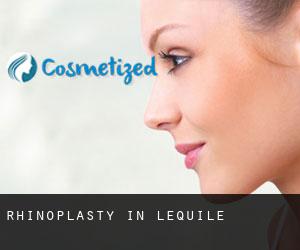 Rhinoplasty in Lequile