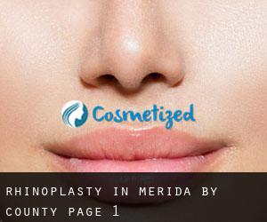 Rhinoplasty in Mérida by County - page 1