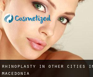 Rhinoplasty in Other Cities in Macedonia