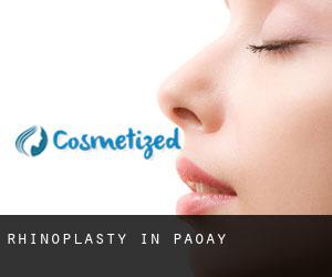 Rhinoplasty in Paoay
