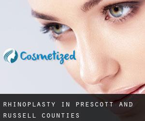 Rhinoplasty in Prescott and Russell Counties