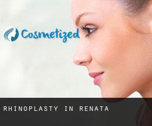Rhinoplasty in Renata