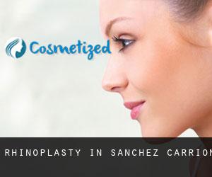Rhinoplasty in Sanchez Carrion
