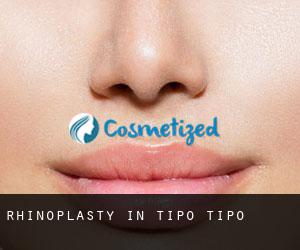 Rhinoplasty in Tipo-Tipo