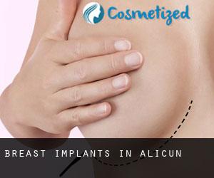 Breast Implants in Alicún