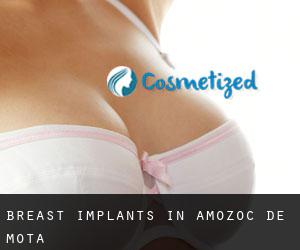 Breast Implants in Amozoc de Mota
