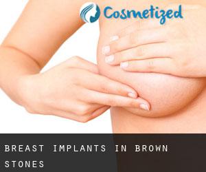 Breast Implants in Brown Stones