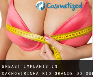 Breast Implants in Cachoeirinha (Rio Grande do Sul)